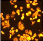 Cy3染料显影SKBR3细胞